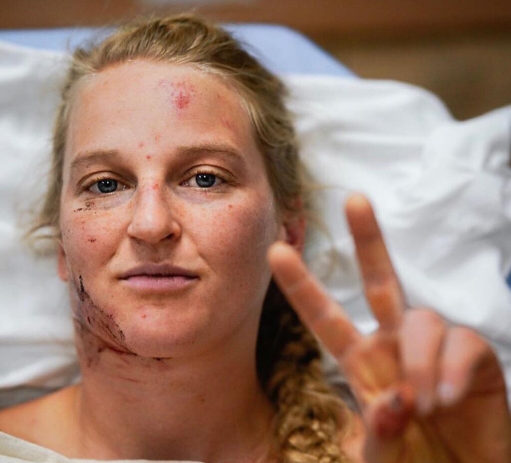 Emily Harrington en el hospital tras sufrir un accidente en El Capitan